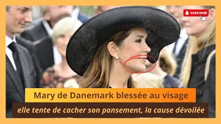 Mary de Danemark tente de dissimuler une blessure au visage  la cause enfin connue [upl. by Jeni]