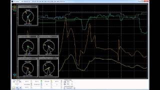 Skoda Fabia CBZB oil temperature and level monitoring [upl. by Audette]