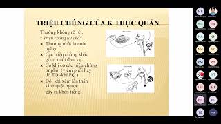 Ngoại tổng quát  Ung thư thực quản [upl. by Candace958]