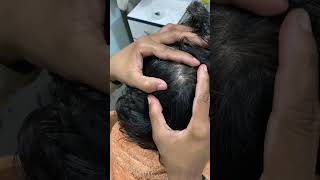 ASMR Wife cleaned husband hair lice 🤪Hair transformation massage 💆 [upl. by Ciro]