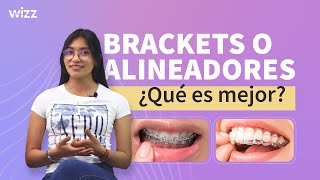 BRACKETS O ALINEADORES ¿Qué es mejor 🏆 [upl. by Ahsoik696]