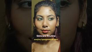 Affordable skincare routine for acneproneskin hyperpigmentationtreatment skincareroutine [upl. by Siraved]