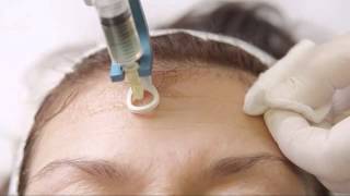 Mesotherapy The Video BK Pistor [upl. by Moreen]