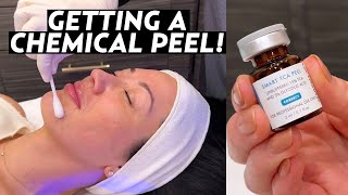 I Got a Chemical Peel My Experience With SkinCeuticals TCA Peel for Hyperpigmentation amp Melasma [upl. by Eldridge179]