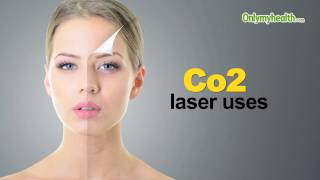 Co2 laser uses  Onlymyhealthcom [upl. by Branscum]