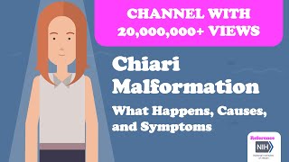 Chiari Malformation  What Happens Causes and Symptoms [upl. by Francene]