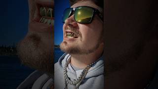 Moissanite Grillz From IceGiant Full Review Video Dropping Soon theigtofficial01 shorts grillz [upl. by Oruhtra]