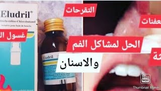 طريقة استعمالEludril من الصيدلية لعلاج تعفنات اللثة وعلاج التهاب اللثة [upl. by Atikram506]