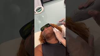 Have you ever considered Laser Hair Removal pcos pcoshairgrowth laserhairrremovalblackwomen [upl. by Aivek]