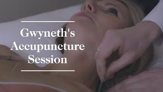 Gwyneth Paltrows Acupuncture Session  goop [upl. by Darooge]