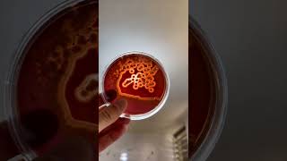 Gram Staining👨‍🔬 Positive Patient Sample After Incubation 48 Hours Growth🦠🔬 lab microbiology [upl. by Nesbitt]