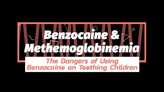 Benzocaine Dangers amp Teething  Methemoglobinemia  Family Dentistry  Downers Grove Illinois [upl. by Damahom]