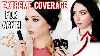 MY TOP FOUNDATIONS FOR ACNE amp TEXTURED SKIN FullExtreme Coverage Makeup  Fair Skin [upl. by Rokach]