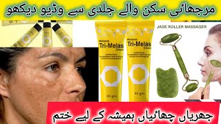 Tri Melas Cream Uses and Benefits Freckles and Melasma [upl. by Ana]