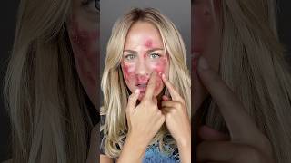 MRSA viralvideo creepy makeup makeuptransformation scary [upl. by Haisoj]