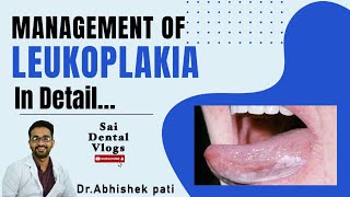 MANAGEMENT OF LEUKOPLAKIA IN DETAIL [upl. by Yoshi]