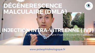 Dégénérescence maculaire liée à lâge DMLA et injection intravitréene IVT Pole Ophtalmologique [upl. by Doreen]