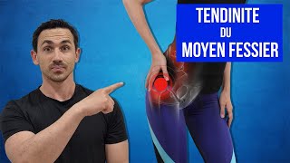 Tendinite du Moyen Fessier  Traitements Étirements et Exercices Kiné [upl. by Emoryt398]