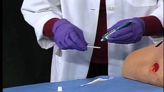 3M™ Tegaderm™ Hydrogel Wound Filler  Application and Removal [upl. by Ranson]