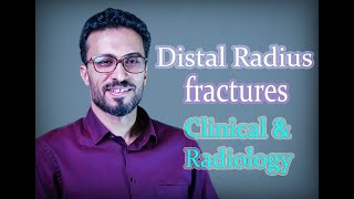 02 Distal radius fractures Clinical amp Radiology [upl. by Faustine]