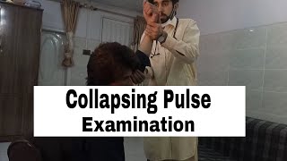 Collapsing Pulse Clinical ExaminationCausesPathologyvascular [upl. by Narhem]