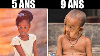 Les 10 ENFANTS les plus INCROYABLES et UNIQUES au MONDE   Nalak [upl. by Ellak]