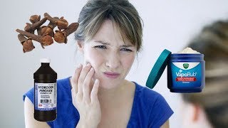 Relief from Tooth Pain  Try These 9 Home Remedies For A Toothache Pain Fast [upl. by Ardel]