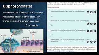 Osteoporosis Bisphosphonates Alendronate Risedronate Zoledronic acid Roze pharm [upl. by Jeffers890]