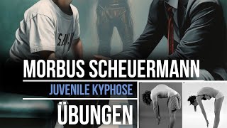 Übungen Morbus Scheuermann  Juvenile Kyphose  Rundrücken [upl. by Nyleuqaj]