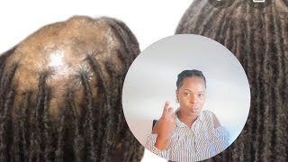 Mistakes You’re Making When Doing a Twist Out [upl. by Tillinger92]