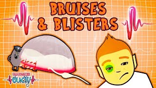 Operation Ouch  Bruises amp Blisters  Human Skin [upl. by Sirret]