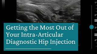 10 Tips for Getting the Most Out of Your IntraArticular Diagnostic Hip Injection [upl. by Kylila971]