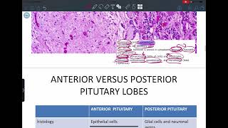 Endocrine pathology lecture 1 [upl. by Amalee752]