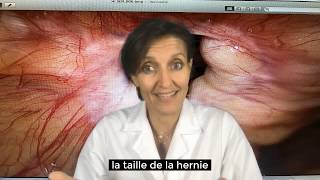 Explication de la hernie ombilicale [upl. by Ori]