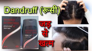 Zocon KZ shampoo uses  Ketoconazole shampoo use in hind  Dandruff treatment in hindi रूसी से राहत [upl. by Aicssej]