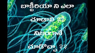 Types of stainings grams stain Ziehl–Neelsen stainBacteria ni ela chudalimicrobiology medtelugu [upl. by Adolfo]