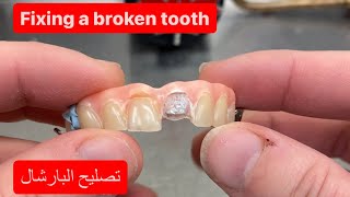 REPAIRING A CAST METAL PARTIAL DENTURE [upl. by Leakcim376]