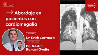 Abordaje en pacientes con cardiomegalia por el Dr Erick Carranza [upl. by Amlet]