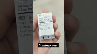 Mantoux test  Tuberculin skin test  TB test  Mycobacterium tuberculosis test tbtest mantoux [upl. by Johen]