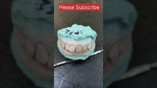 Dental cap on toothsmile trending mydentist [upl. by Adel]