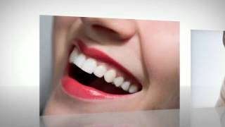 Teeth Whitening Foam [upl. by Hazem]