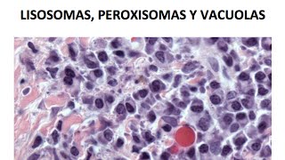 Lisosomas peroxisomas y vacuolas [upl. by Marchese]