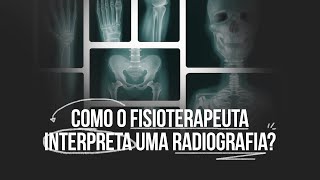 Como o fisioterapeuta interpreta uma RADIOGRAFIA [upl. by Huberty]