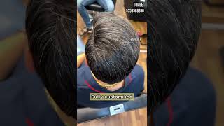 Custom hair systems in Bangalore Salt amp Pepper hair  Baldness solution for men hair patch for men [upl. by Robbin]