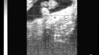 Bovine pregnancy 40 days with EasiScan ultrasoundwmv [upl. by Airamzul]