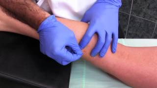 Punción seca del músculo gemelo interno Dry needling [upl. by Gerik458]