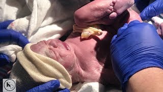 INDUCED AT 33 WEEKS PREGNANT  PREMATURE BABY  NICU JOURNEY [upl. by Jaddan]