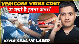 Cost of venaseal  glue treatment for varicose veins  Dr Gaurav Gangwani IR [upl. by Flavian]