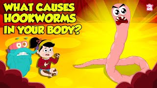 What causes Hookworm। Intestinal Worms Symptoms and Treatment  Worm Infection  Dr Binocs Show [upl. by Forland]