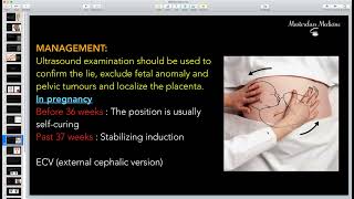 Malpresentation 2  OB course  Masterclass Medicine [upl. by Adiam]